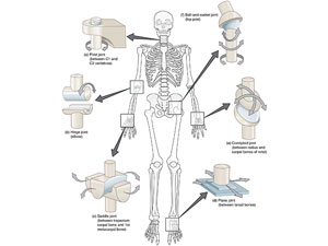 Muscular skeletal conditions